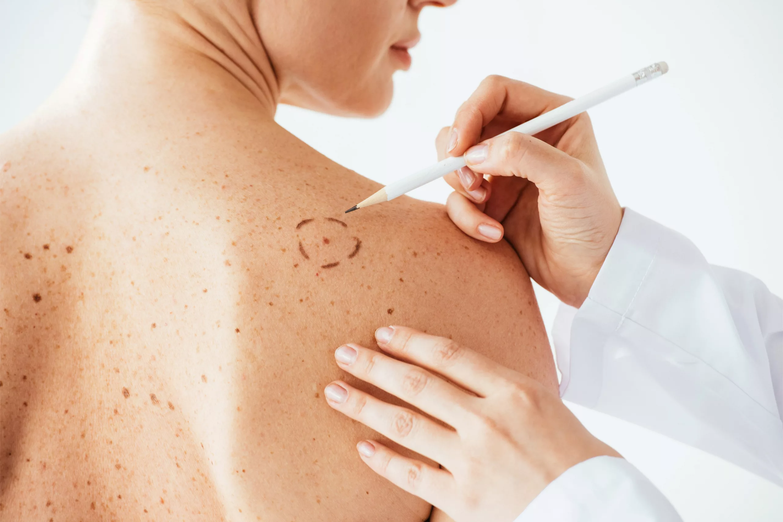 Médecine morphologique anti-âge